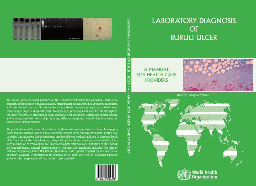 Laboratory diagnosis of buruli ulcer