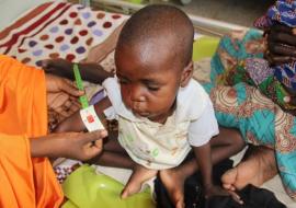 MUAC measurement shows child on malnutrition red alert Photo-WHO_Chima O